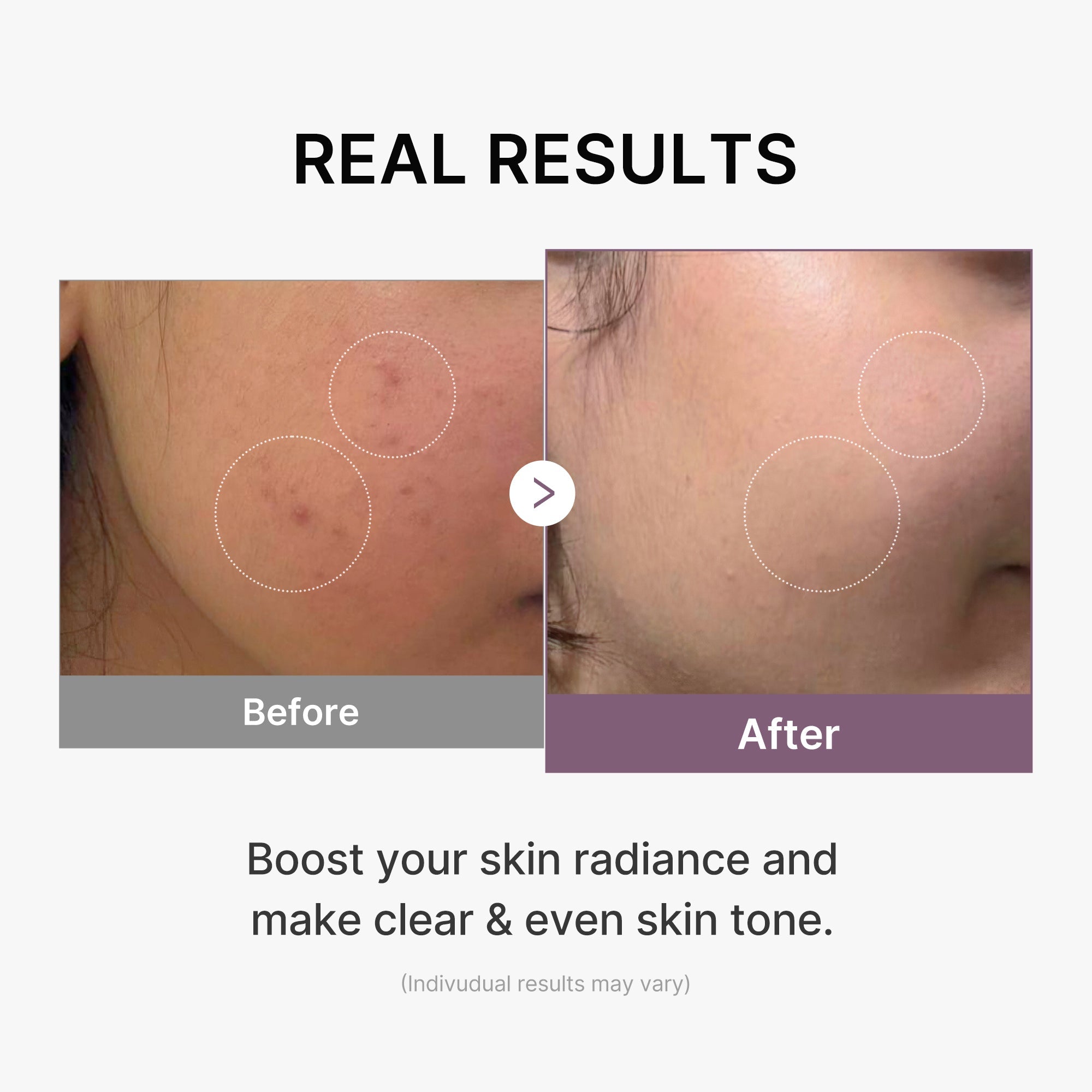 AGE-R Glutathione Glow Milk Toner