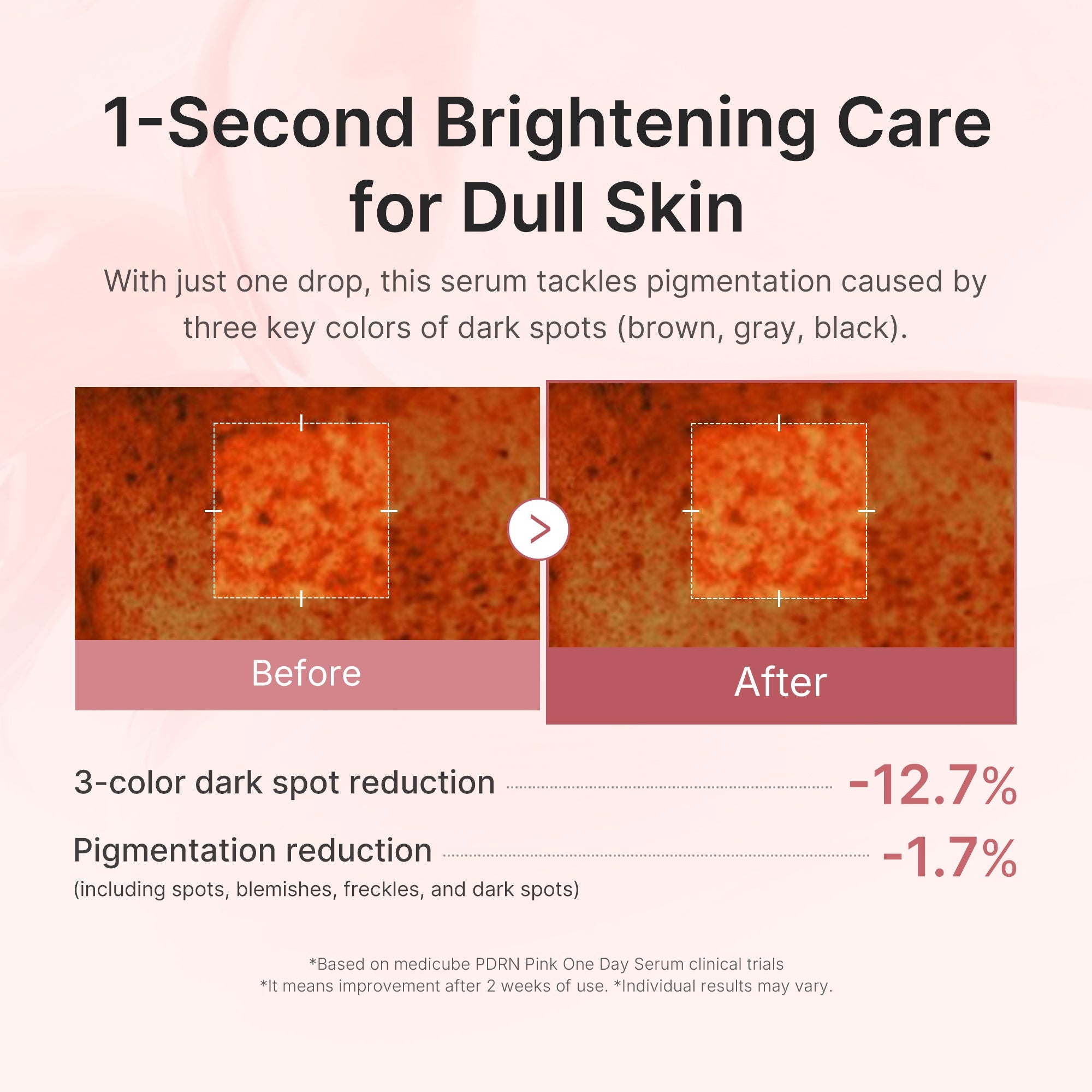 Salmon PDRN Pink One Day Serum
